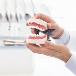 dentadura e implantes dentales