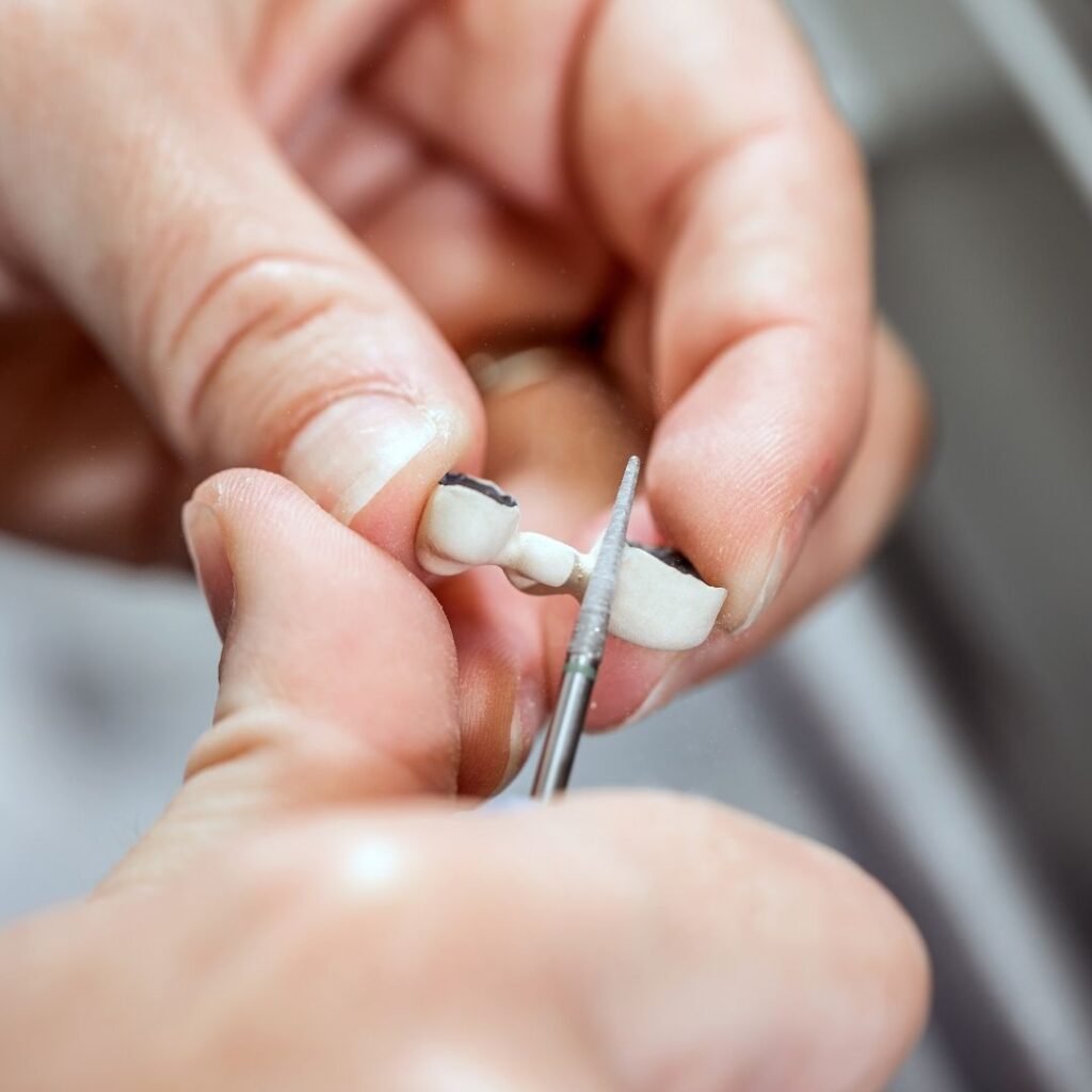 ¿Qué es la osteointegración de los implantes dentales?