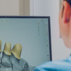implantes dentales guiada por ordenador