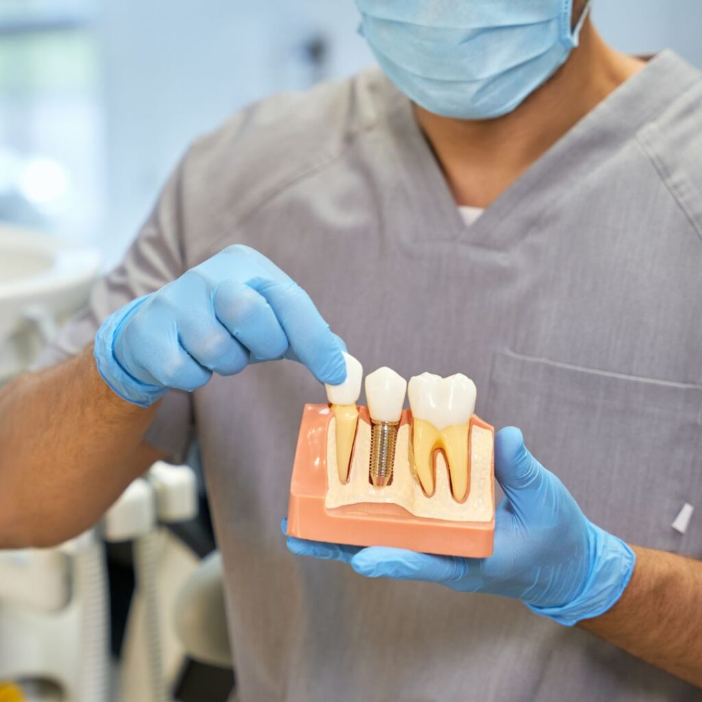 Complicaciones de implantes dentales