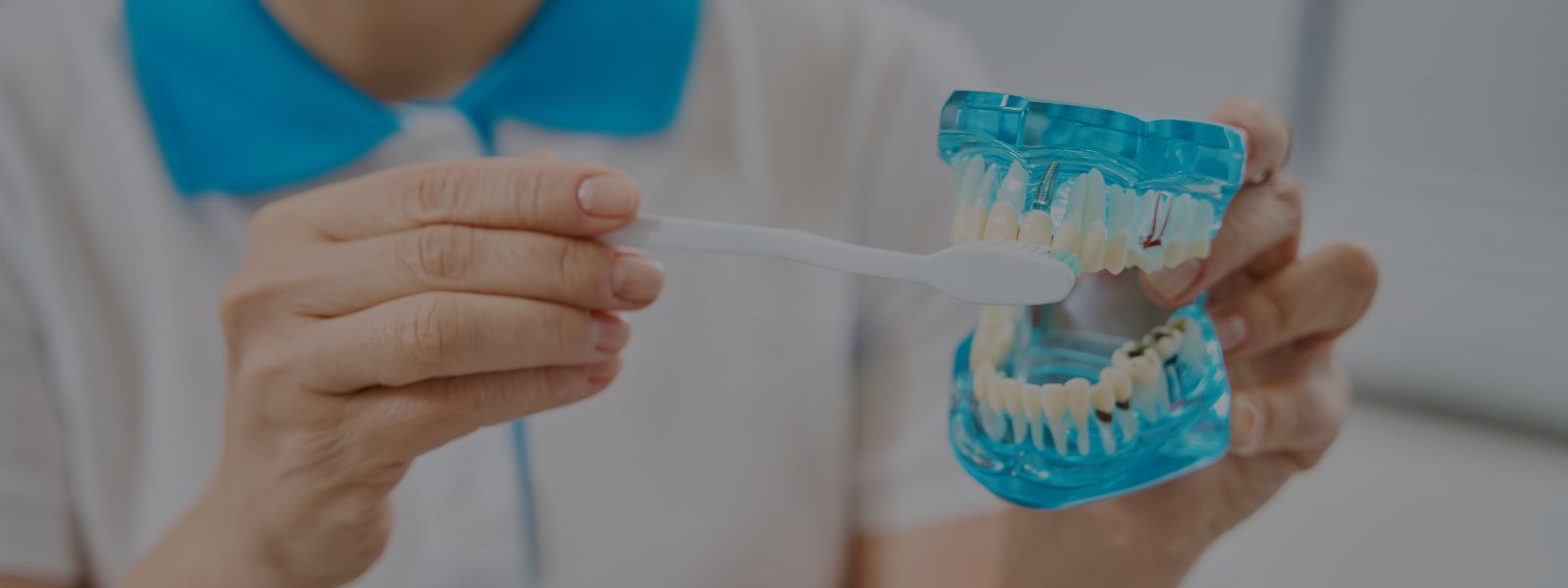 ¿Quién es candidato para implantes dentales?